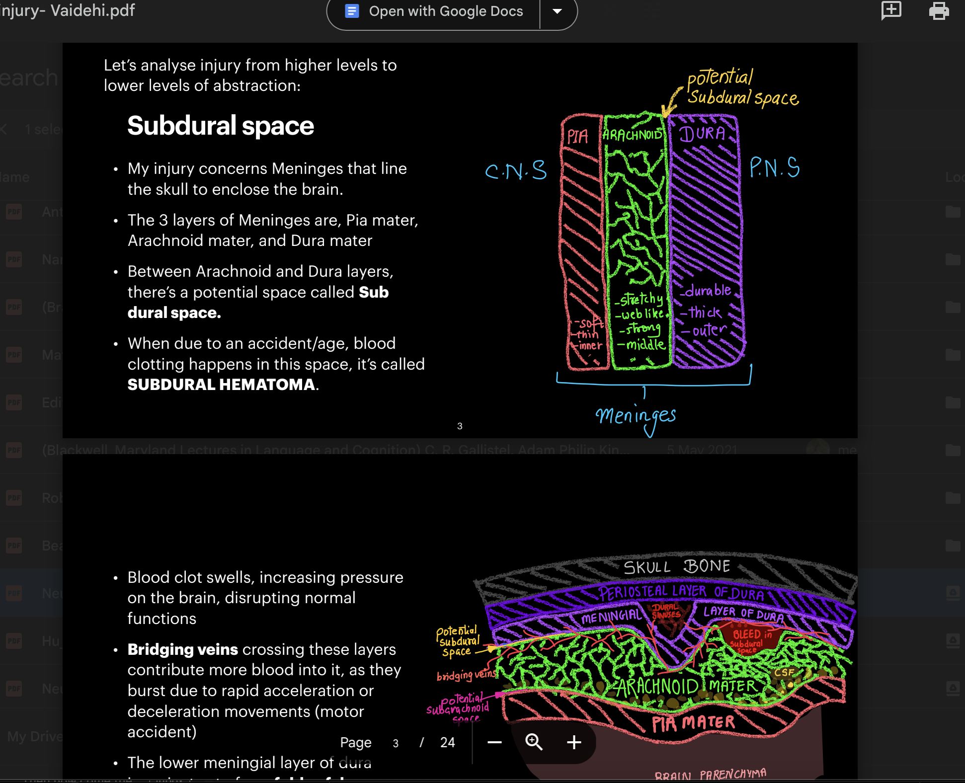 Slide showing meningeal layers between the skull and brain surface
